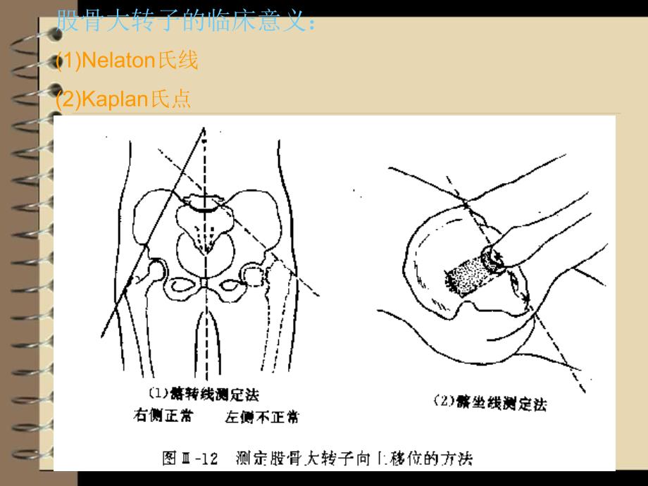 断层解剖学-下肢.ppt_第4页