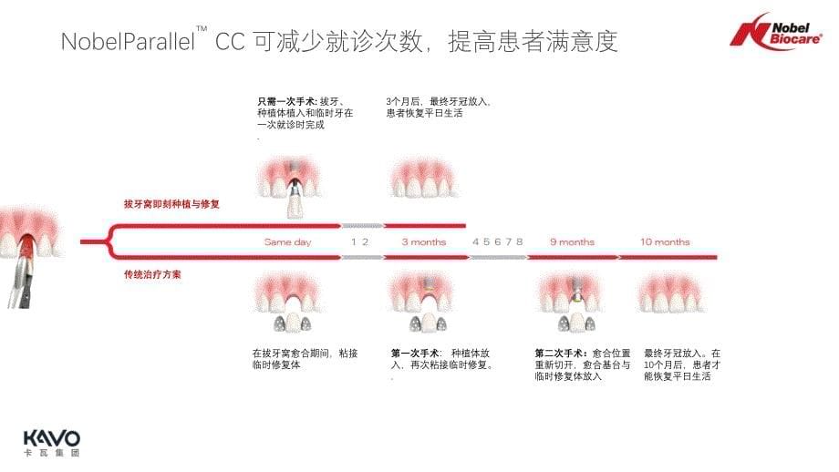 NobelParllelCC咨询师培训.ppt_第5页