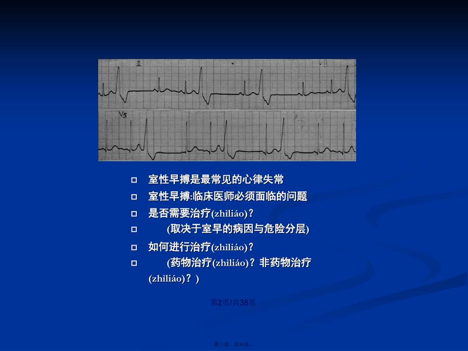 室早搏是否需要治疗学习教案_第3页