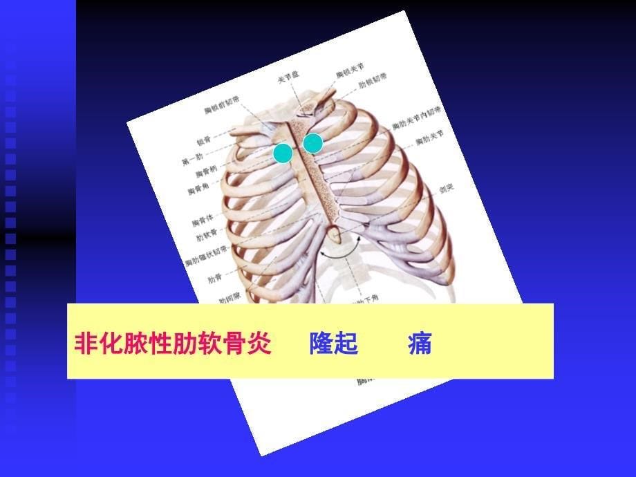 胸痛50恶呕30泄14秘_第5页