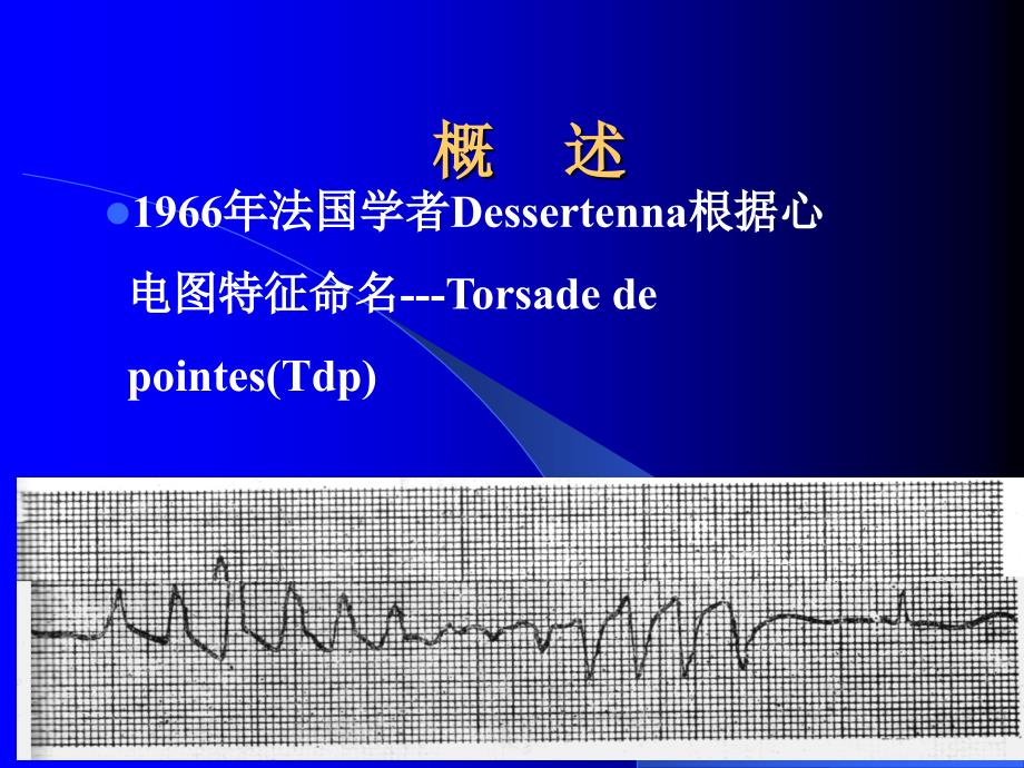 扭转型室性心动过速教案_第2页