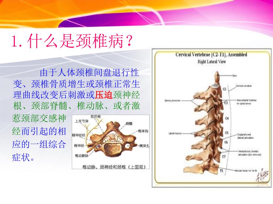 颈椎病的预防保健课件_第4页