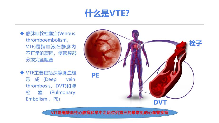 静脉血栓栓塞症（VTE）的诊断和治疗_第3页