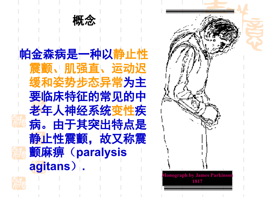 帕金森氏病的护理_第3页