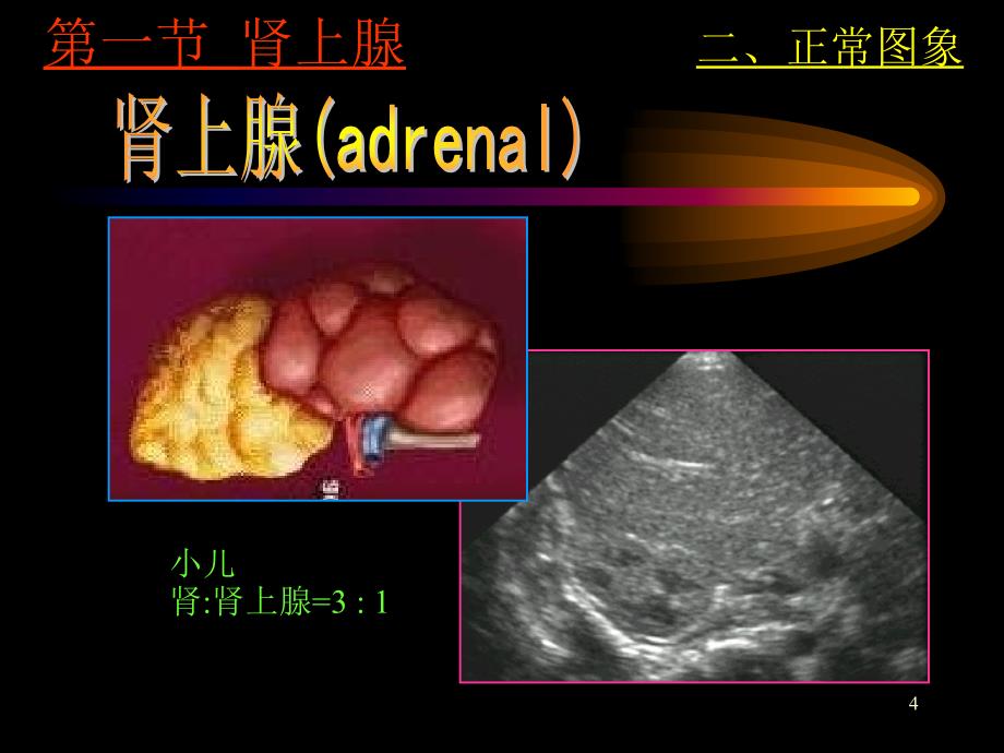 肾上腺超声PPT课件_第4页