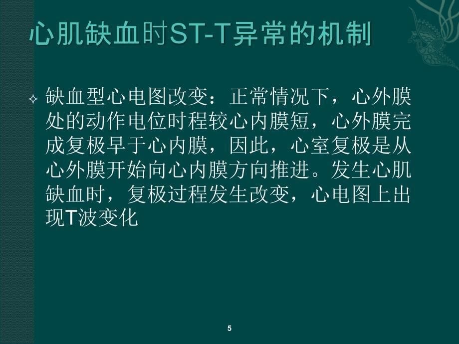 心肌梗死心电图诊ppt课件_第5页