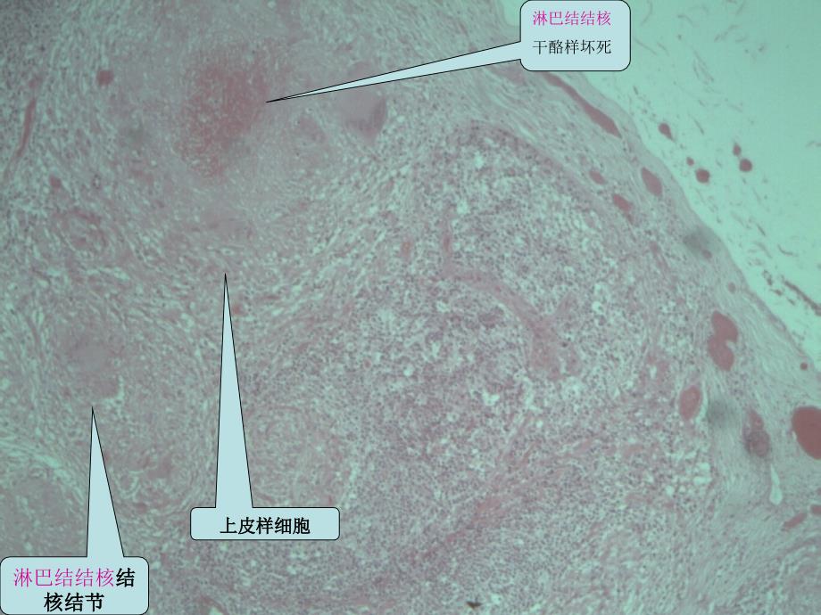 病理学实验课件：传染病、寄生虫_第2页