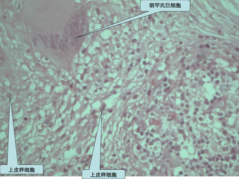 病理学实验课件：传染病、寄生虫_第3页