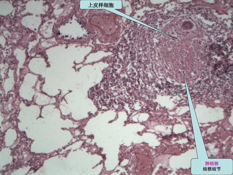 病理学实验课件：传染病、寄生虫_第4页