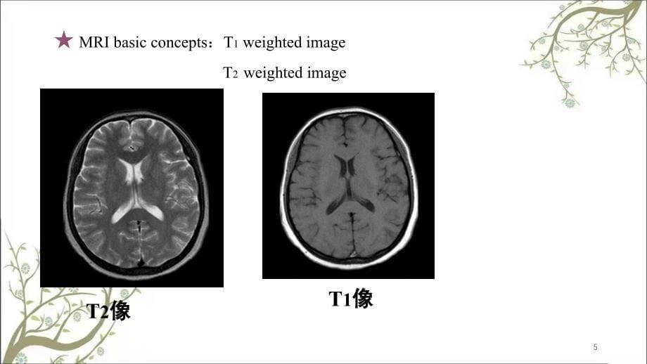 MR临床应用课件_第5页