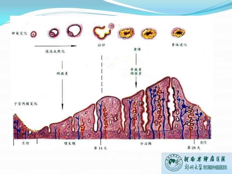 河南省肿瘤医院郑州大学附属肿瘤医院妇瘤科陈红敏课件文档资料_第5页