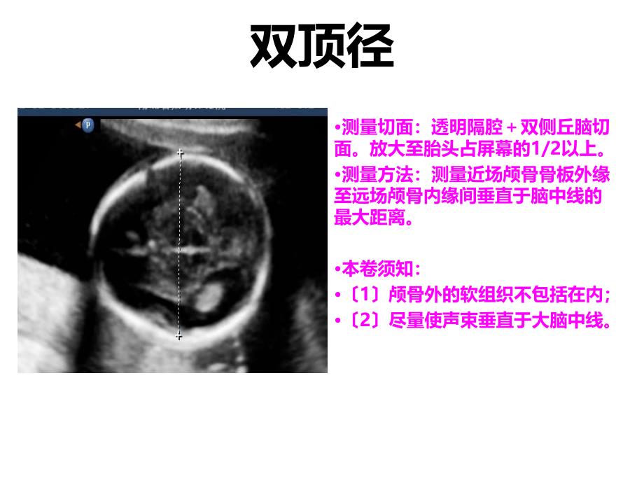 《产科检查常规切面》幻灯片_第3页