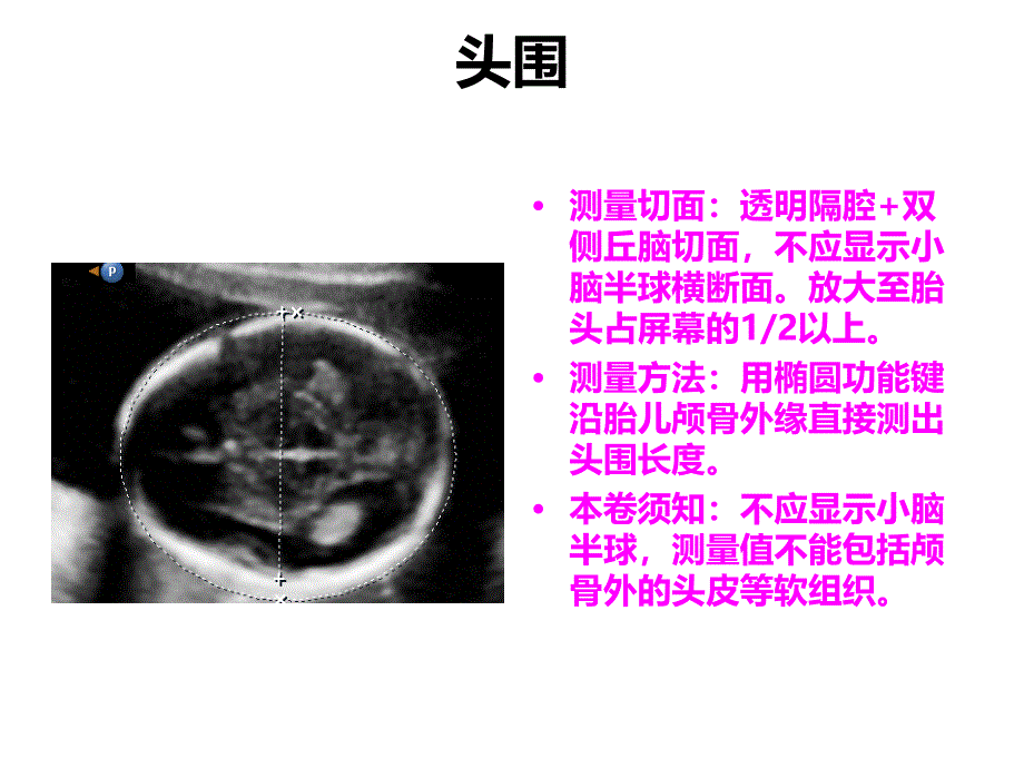 《产科检查常规切面》幻灯片_第4页