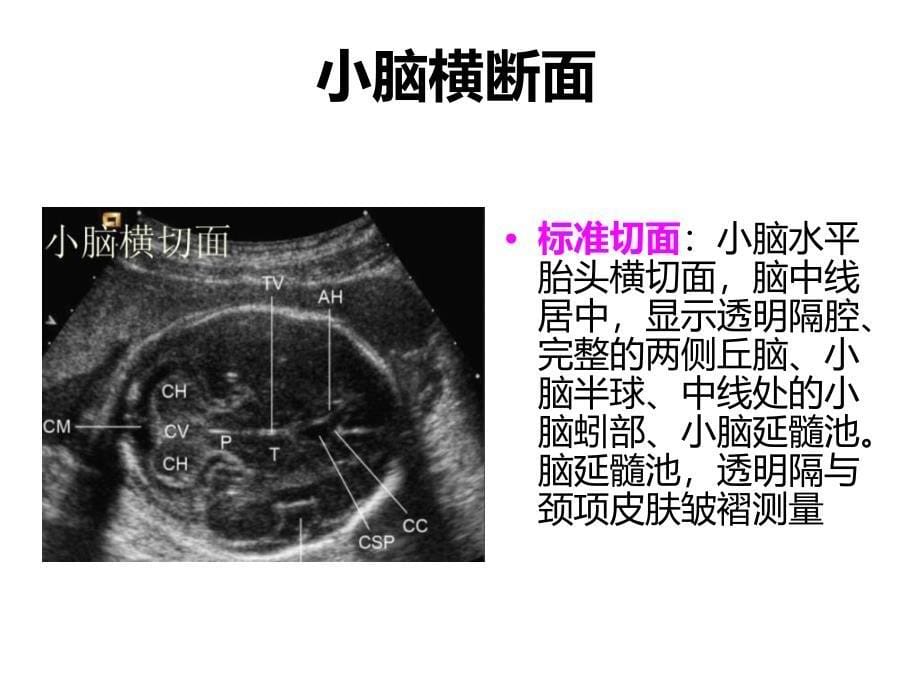 《产科检查常规切面》幻灯片_第5页