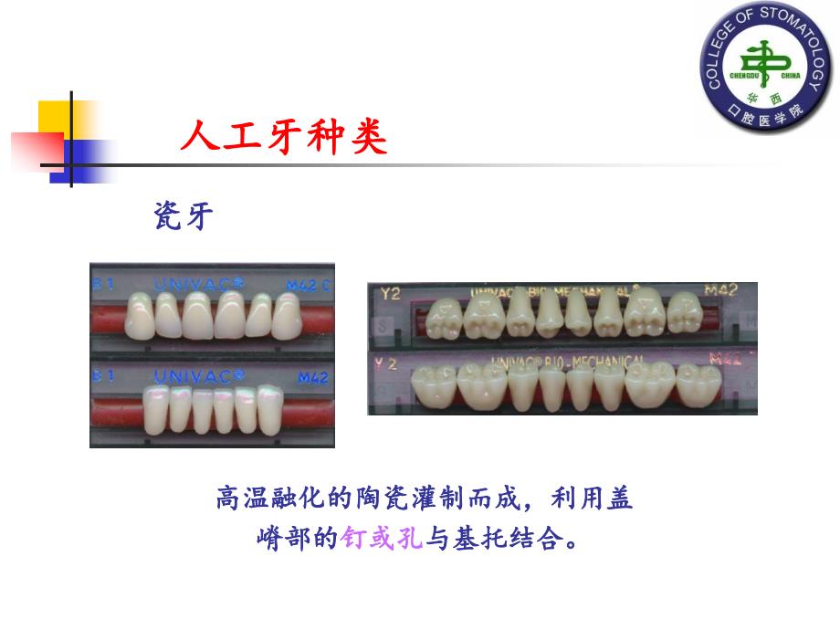 可摘局部义齿的组成及作用 - 可摘局部义齿的组成及作用_第4页