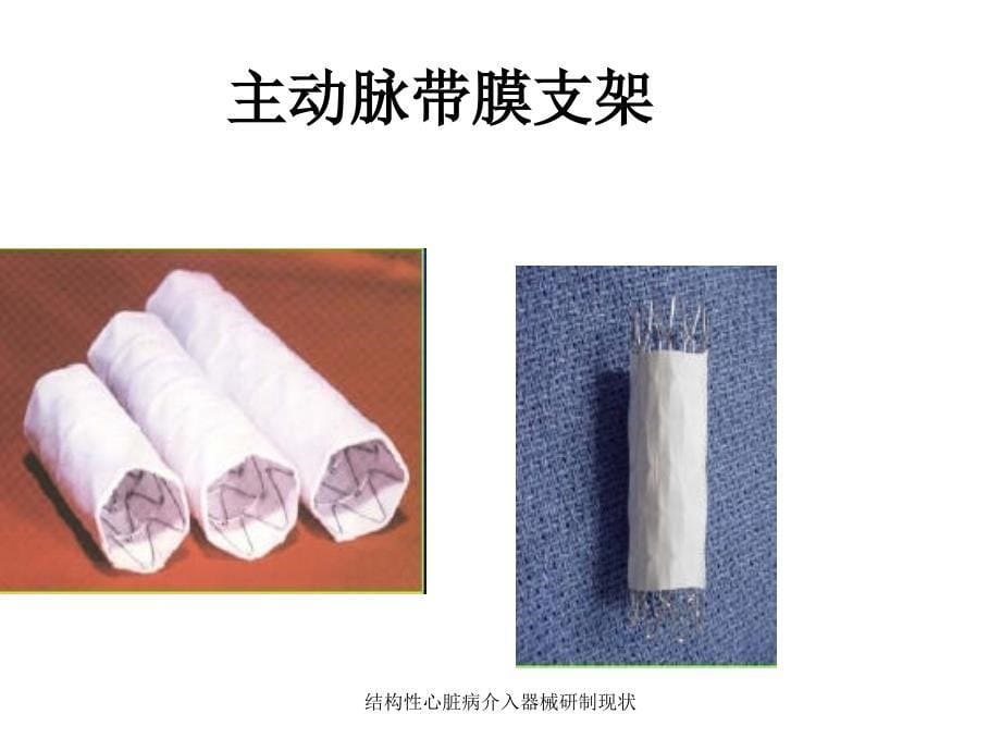 结构性心脏病介入器械研制现状课件_第5页