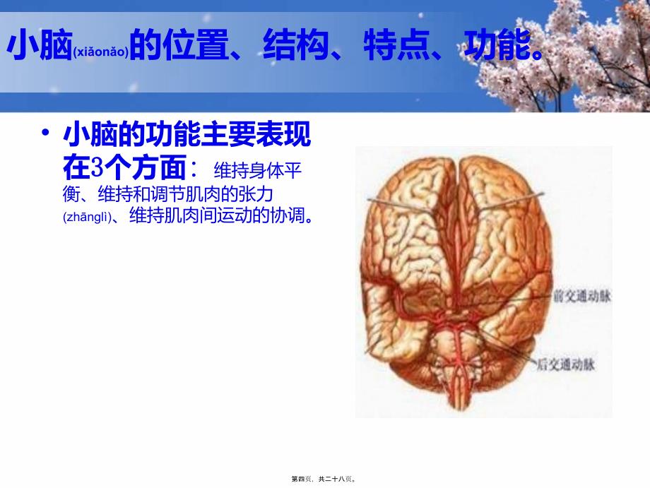 医学专题—小脑出血-2_第4页