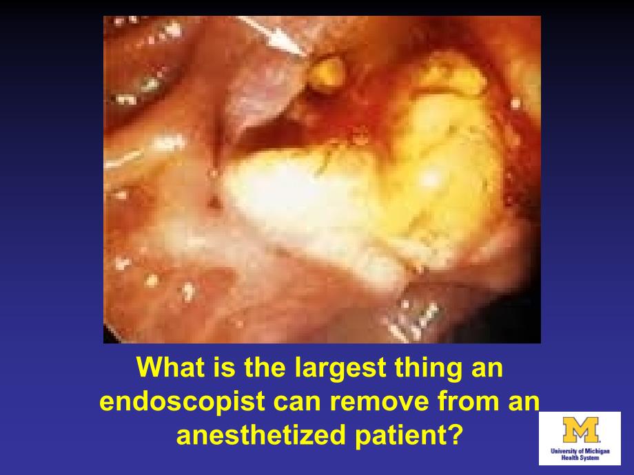 OffSiteAnesthesiaNewChallengesUMAnesthesiology现场外的新的挑战嗯麻醉麻醉_第2页