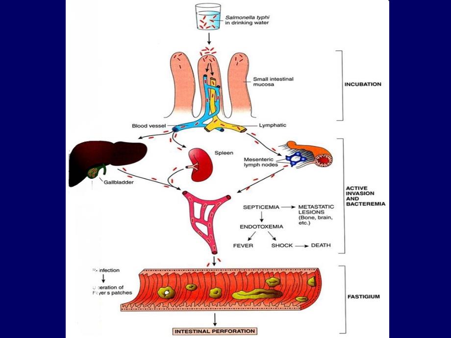 病理学课件：12.传染病 (Infectious Disease)_第5页