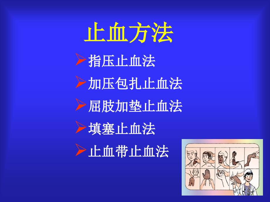 外伤急救技术止血包扎固定搬运_第4页