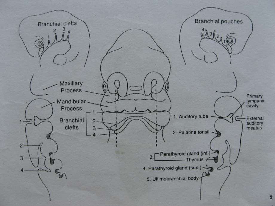 鳃器畸形PPT课件.ppt_第5页