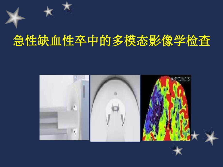 急性缺血性卒中的多模态影像学检查ppt课件.ppt_第1页