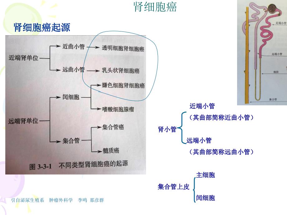 临床病理学：肾细胞癌_第3页