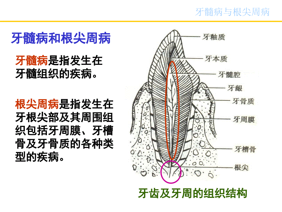 《牙髓病与根尖周病》PPT课件_第4页