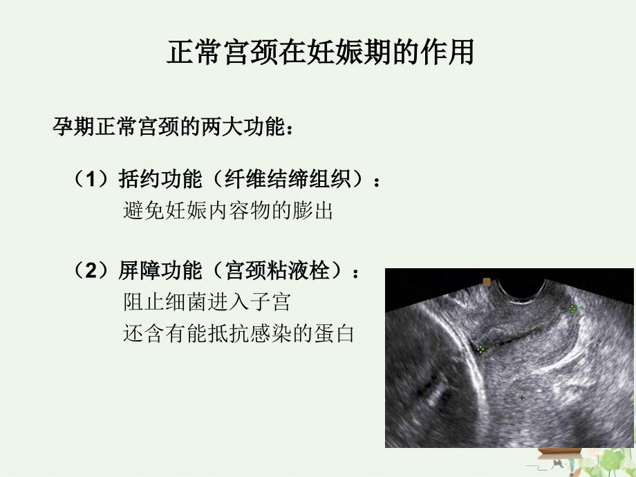 紧急宫颈环扎术的手术指征及术后管理讲课课件_第3页