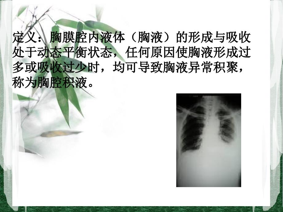 胸腔积液的小讲课_第2页