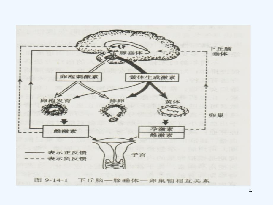 月经失调病人的护理教学ppt课件_第4页