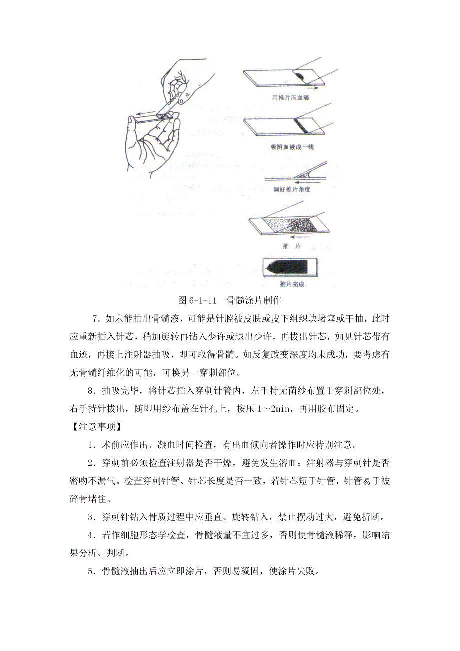 内科医疗操作常规[1]_第4页