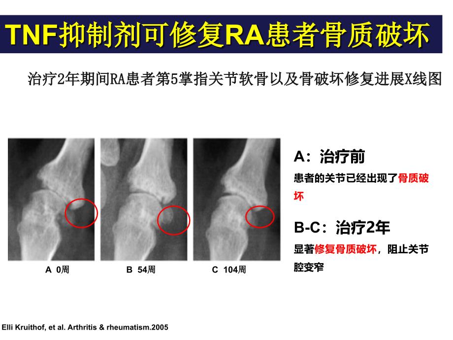 AS的治疗策略_第4页