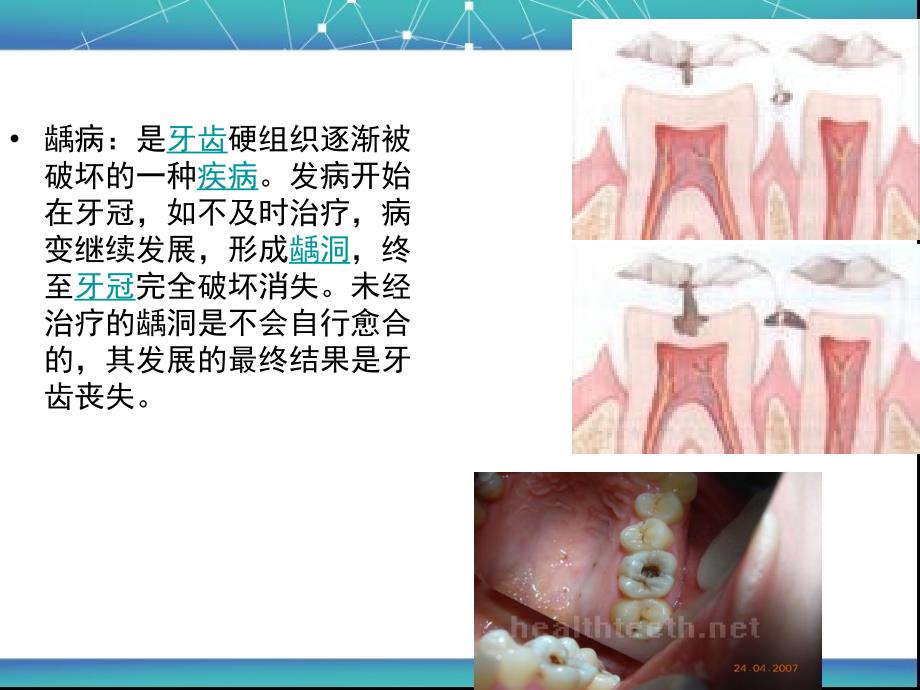 口腔保健知识讲座(一)_第4页