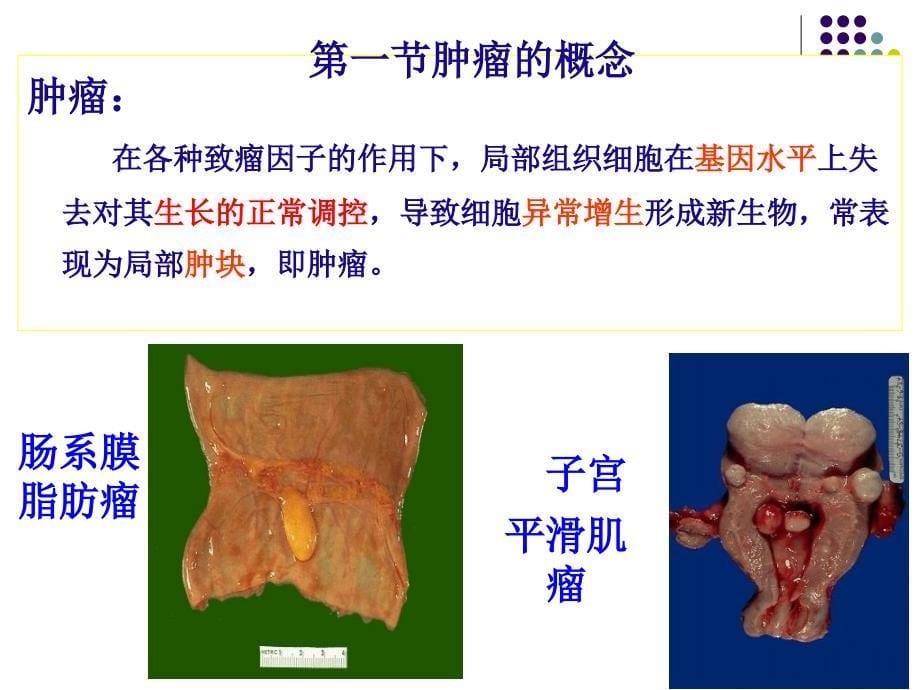 病理学肿瘤PPT课件_第5页