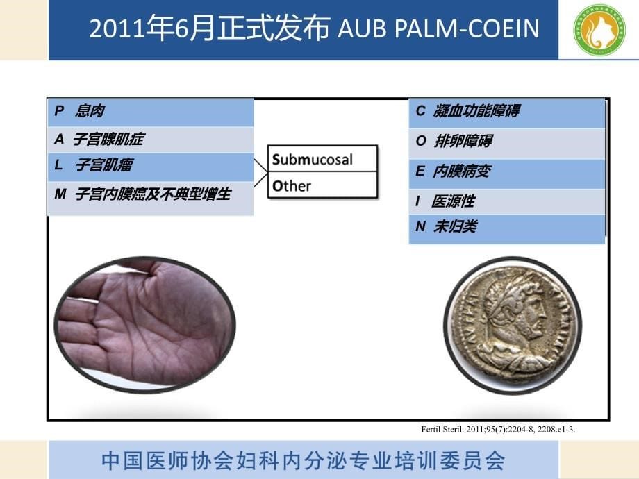 异常子宫出血诊疗指南解读_第5页