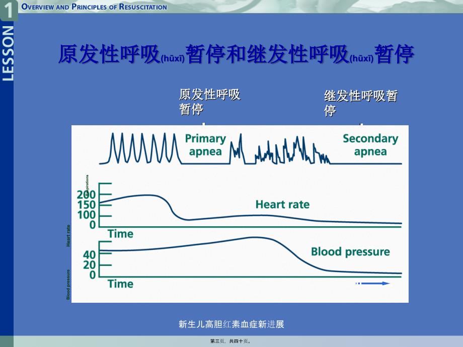 新生儿高胆红素血症新进展课件_第3页