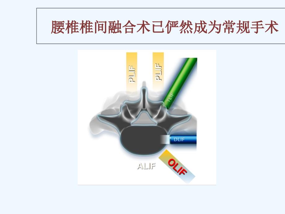 OLIF入路和相关解剖课件_第1页