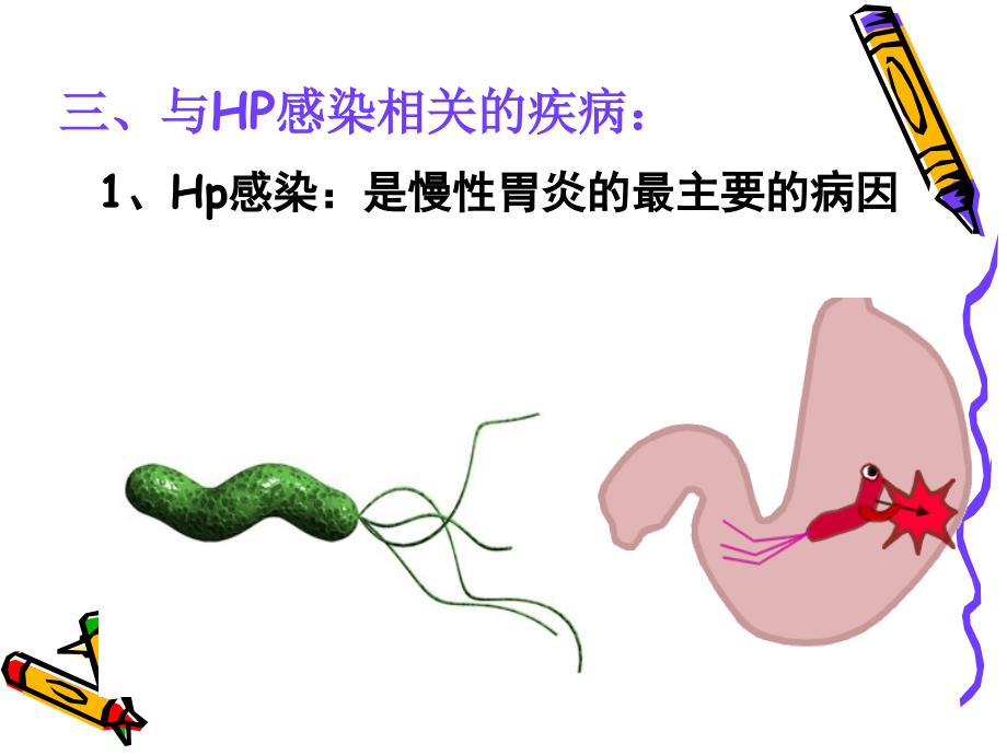 第四次全国幽门螺杆菌感染处理共识课件_第4页