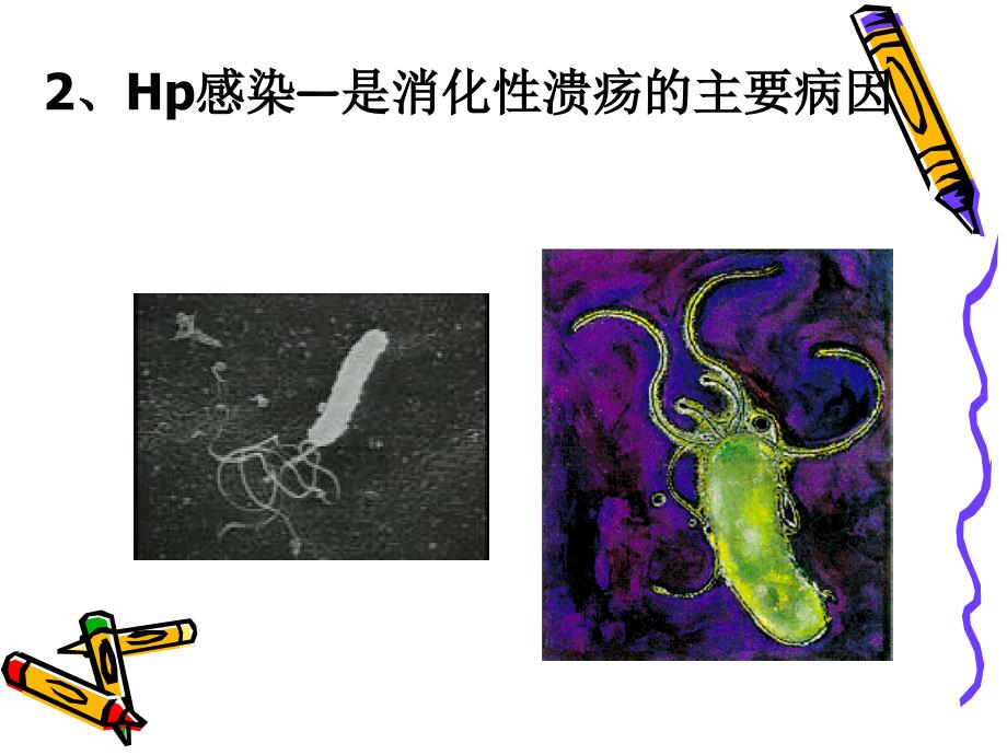 第四次全国幽门螺杆菌感染处理共识课件_第5页