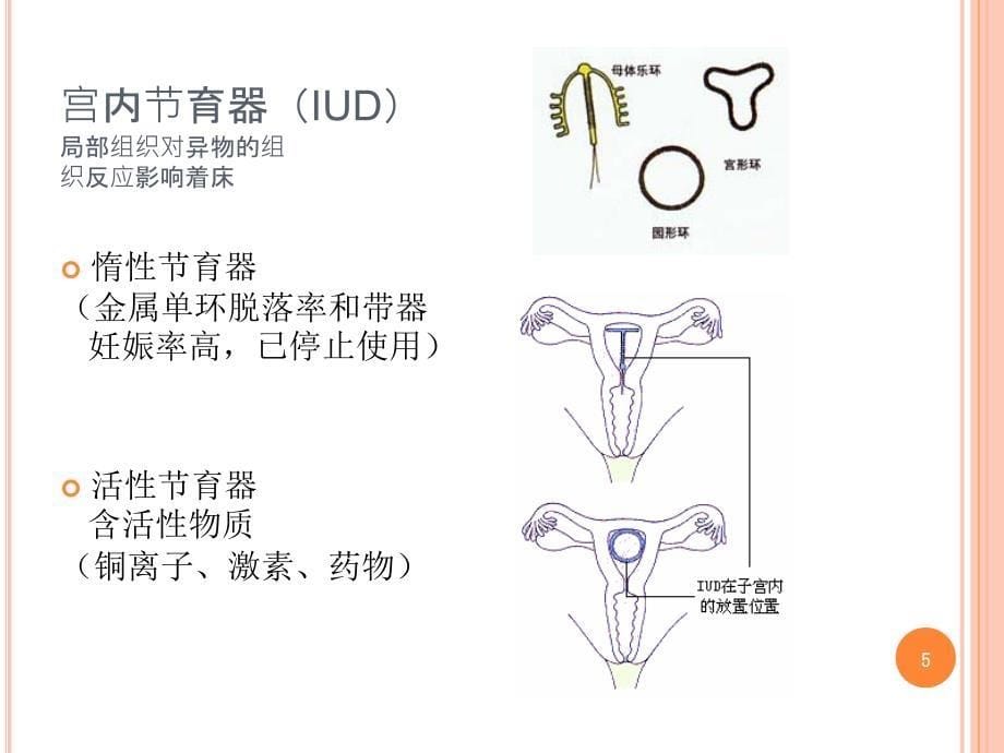 避孕药以外的避孕方式_第5页