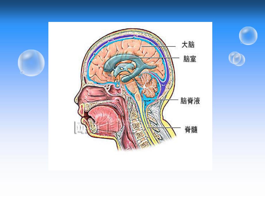 脑脊液漏的观察和护理.ppt_第4页