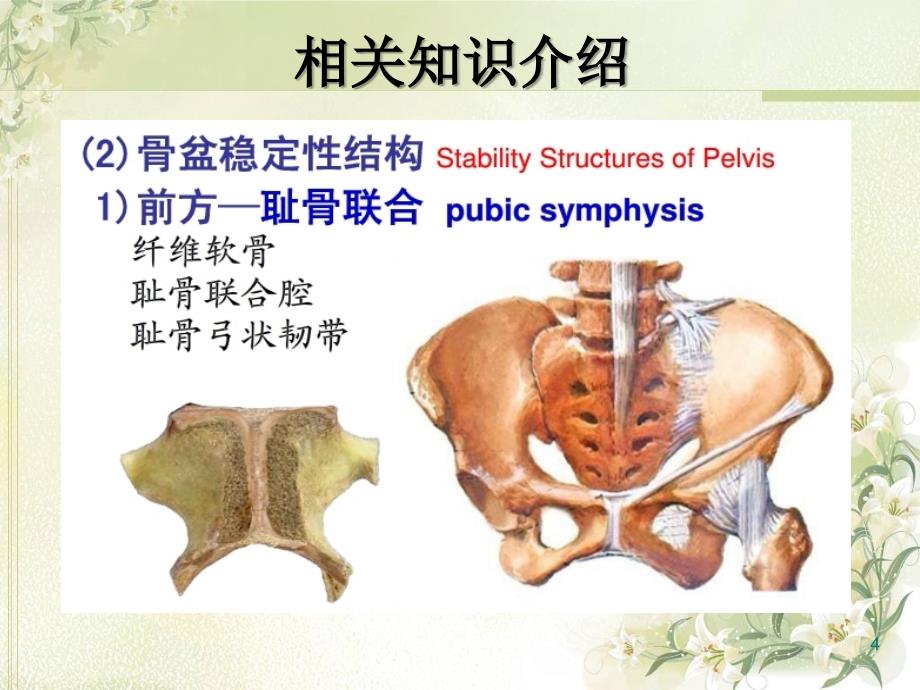 骨盆骨折护理查房PPT参考课件_第4页