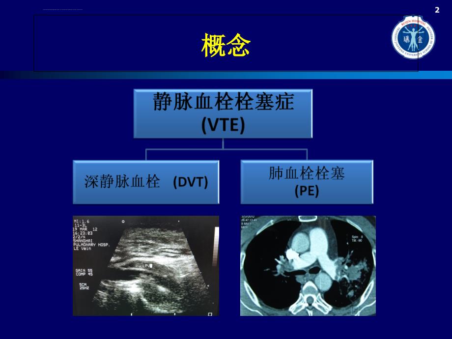 住院患者的VTE风险和防治ppt课件_第2页