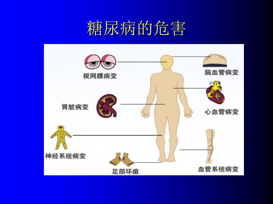 糖尿病的口服降糖药物治疗_第3页