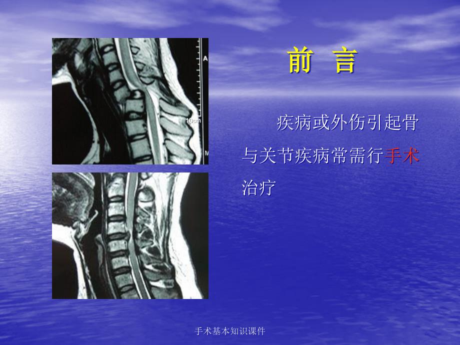 手术基本知识课件_第2页