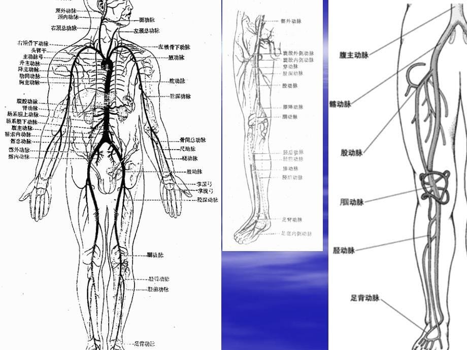 下肢动脉闭塞_第5页