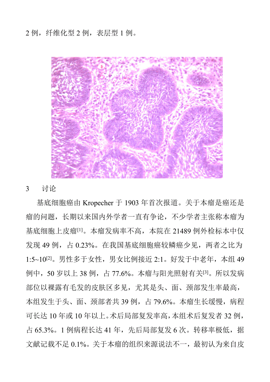 49例基底细胞癌临床病理分析.doc_第3页