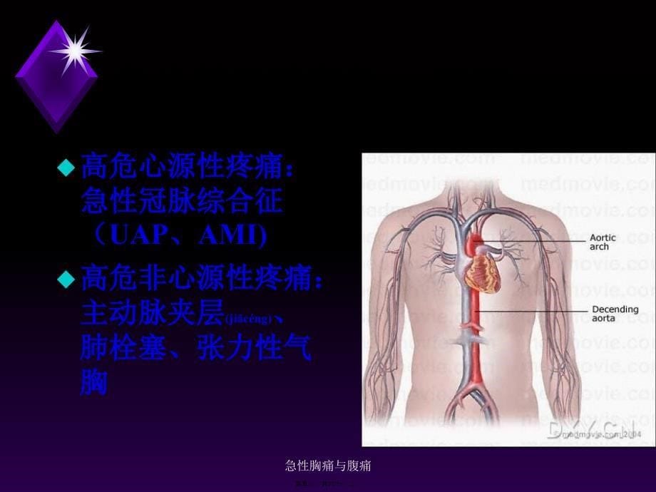 急性胸痛与腹痛课件_第5页