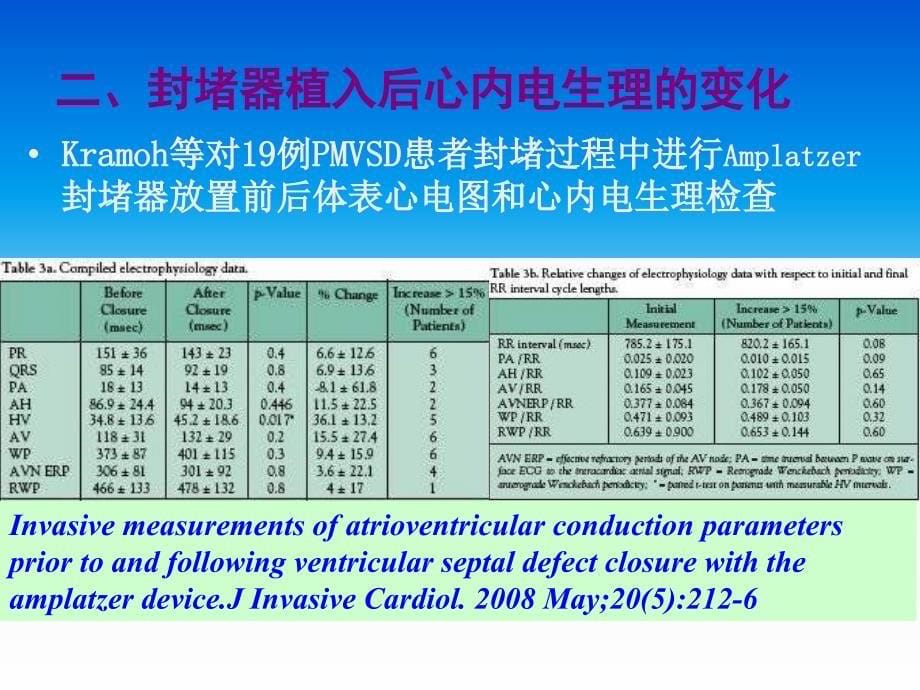 经皮导管封堵器植入对膜周部室间隔缺损患者心脏传导系统影响_第5页